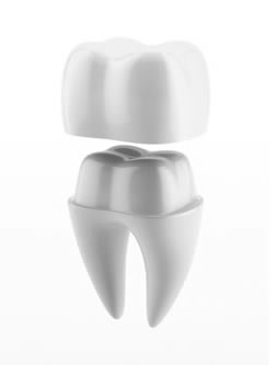 Dental Crowns and Bridges - Blincoe and Shutt Aesthetic Dentistry
