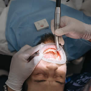Teeth Cleaning - Checkups - Blincoe and Shutt Aesthetic Dentistry